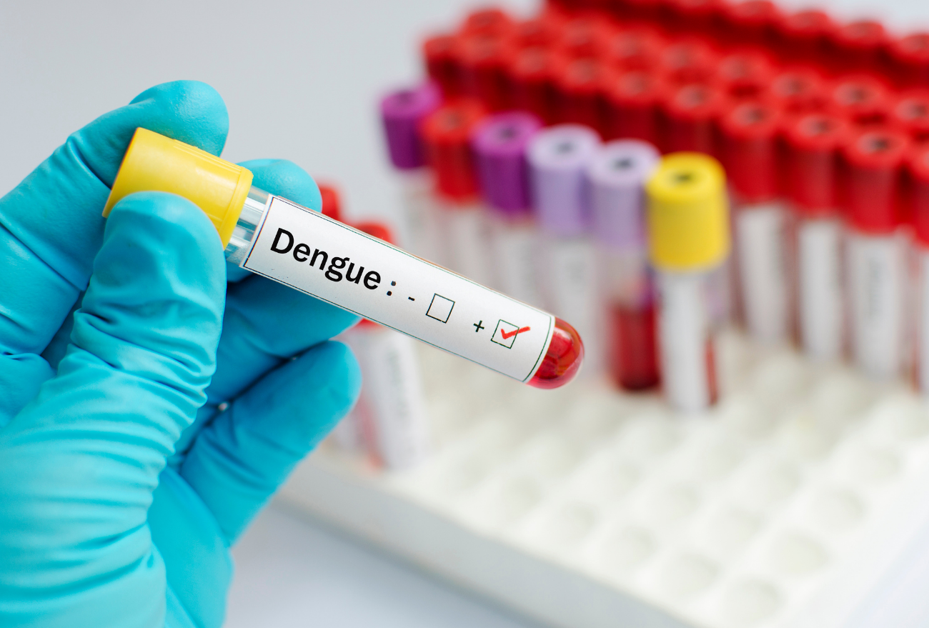 Confira o boletim da Dengue para esta segunda-feira (4)
