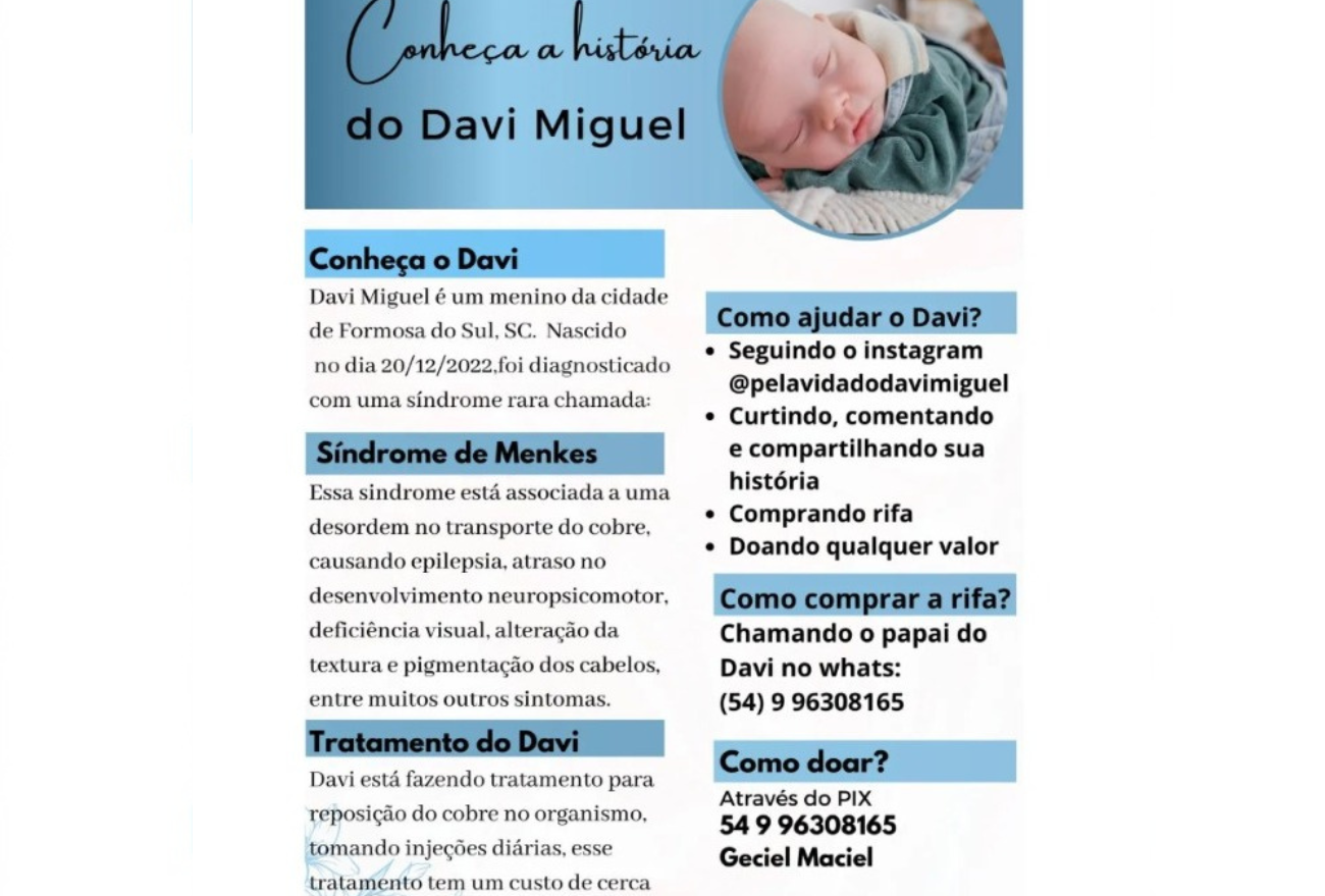 Conheça a história do pequeno Davi Miguel que tem síndrome de Menkes