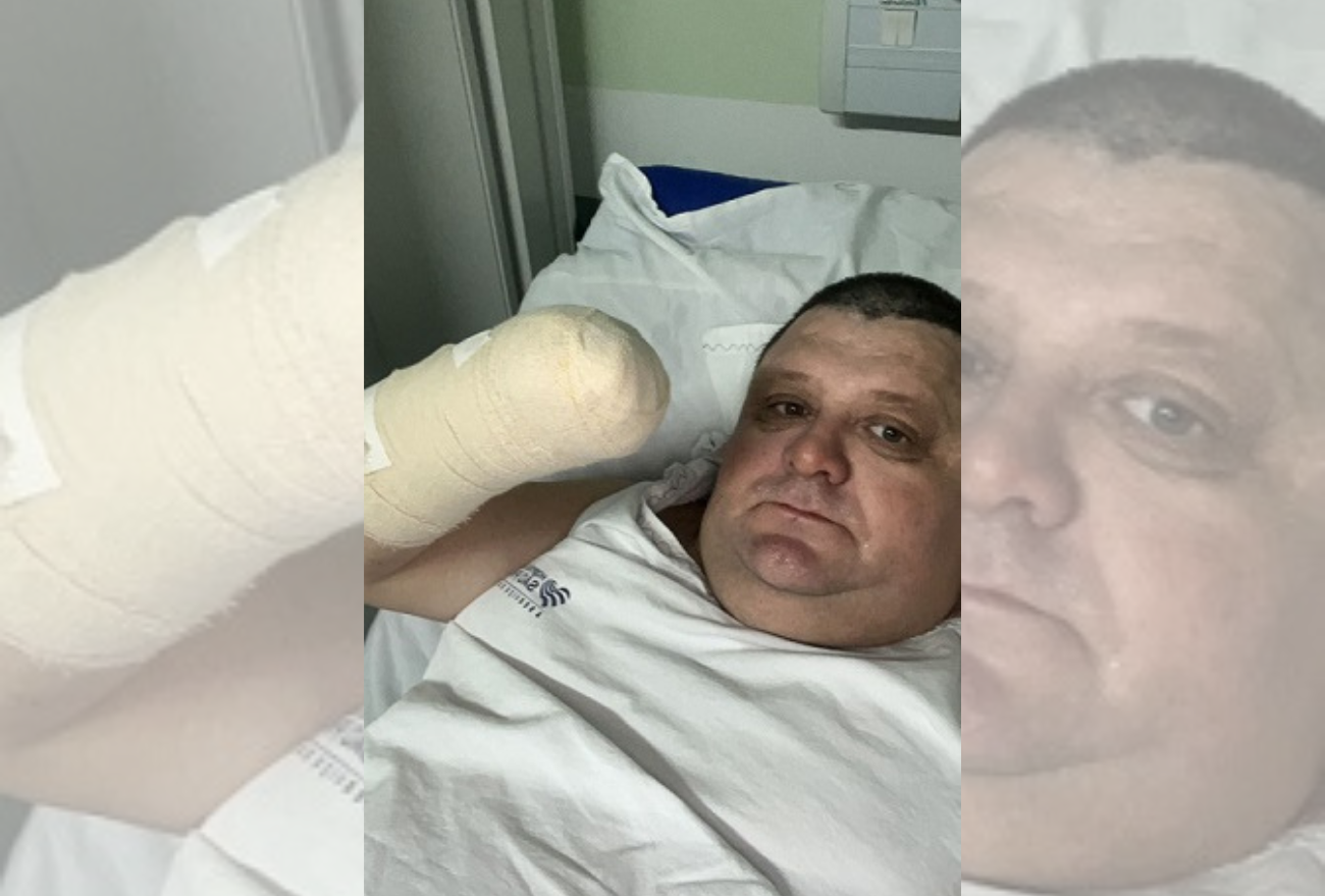 Humorista “Pilha” perde a mão após estourar foguete, em Xaxim